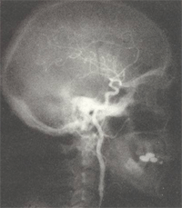 xray