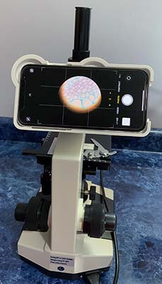 Phone and Adapter on Microscope