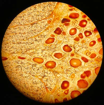 Nervous Tissue at 400x