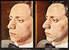 Stereoscopic Skin Clinic Cards Medical Slide