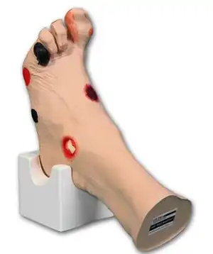 Wilma Wound Foot