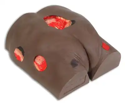 Seymour Wound Care Model
