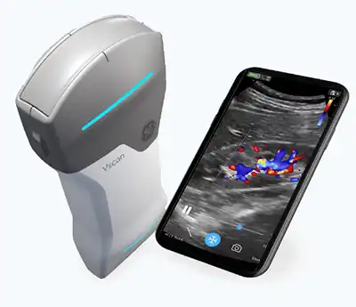 GE VScan Air