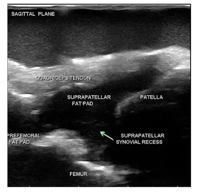 Portable Ultrasound Imaging