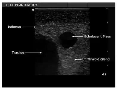 Thyroid Trainer Screen