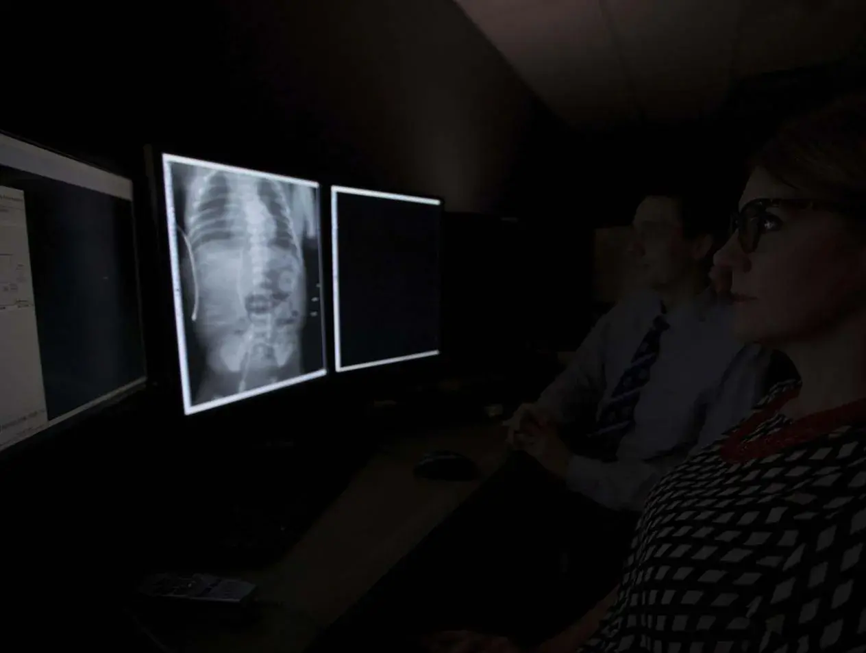 X-Ray review