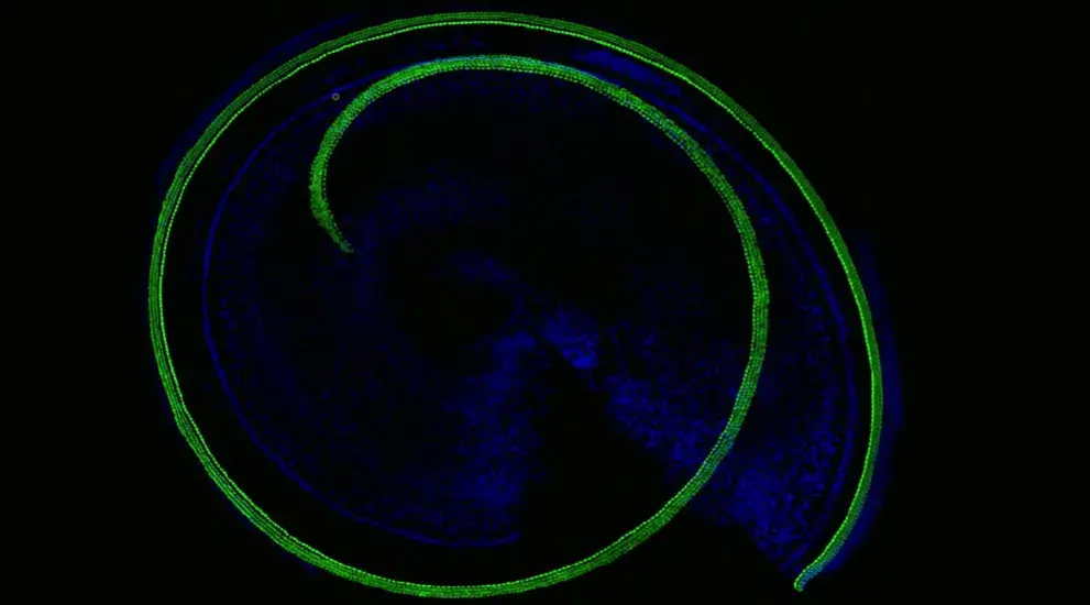 Cochlea image