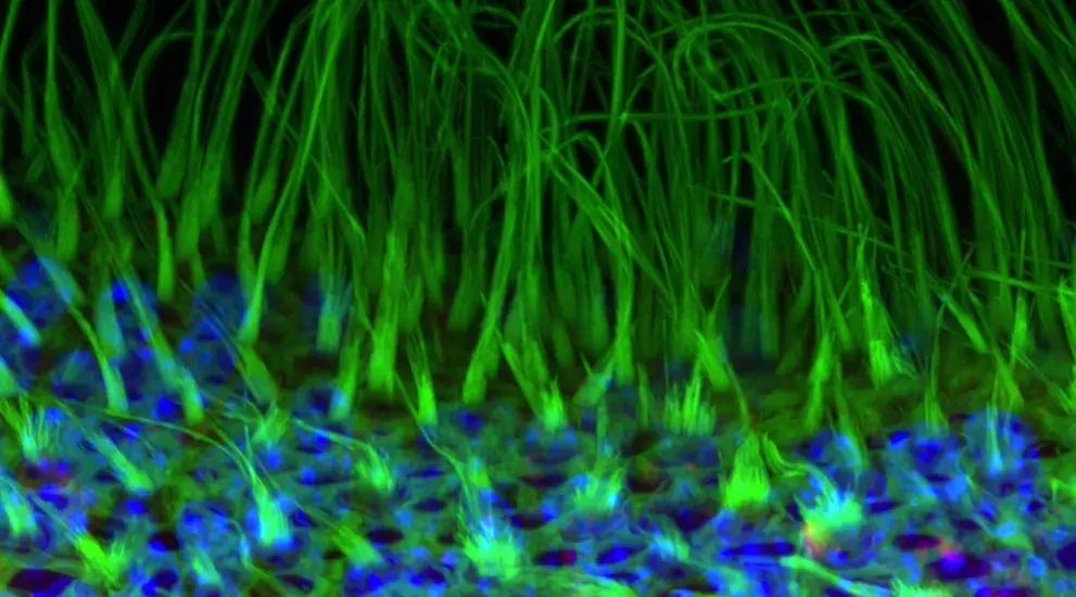 Mouse hair cells